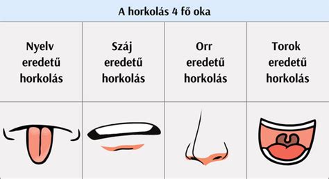 Életkilátásainkat is rontja a horkolás